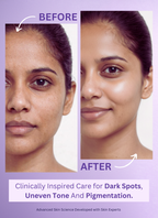 Niacinamide 10% Face Serum